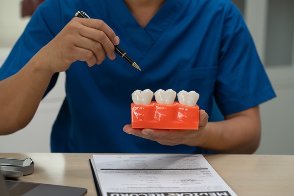 Restore Your Smile With Dental Crowns: What You Should Know