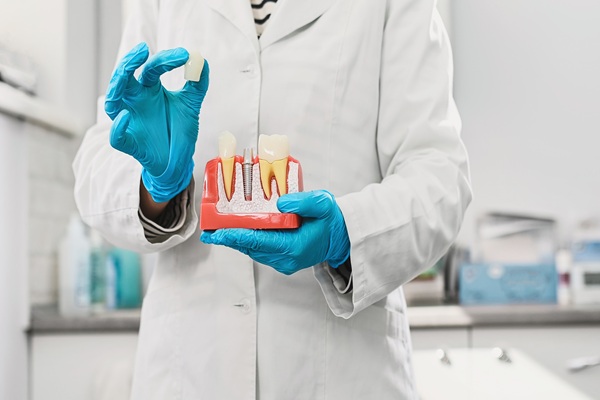 Missing A Single Tooth? Consider A Dental Implant